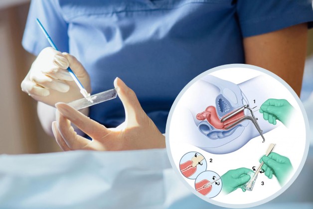 Quy trình xét nghiệm K cổ tử cung được thực hiện theo các bước khoa học, nhanh chóng và nhẹ nhàng