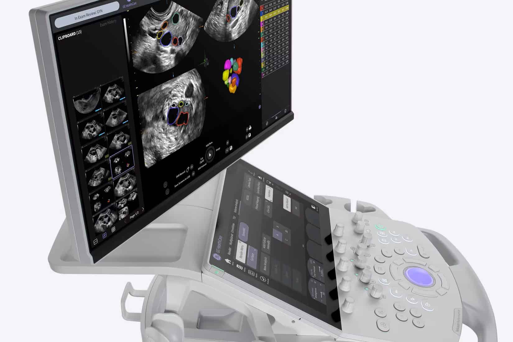 Máy Voluson - dòng máy siêu âm cao cấp nhập khẩu từ Mỹ