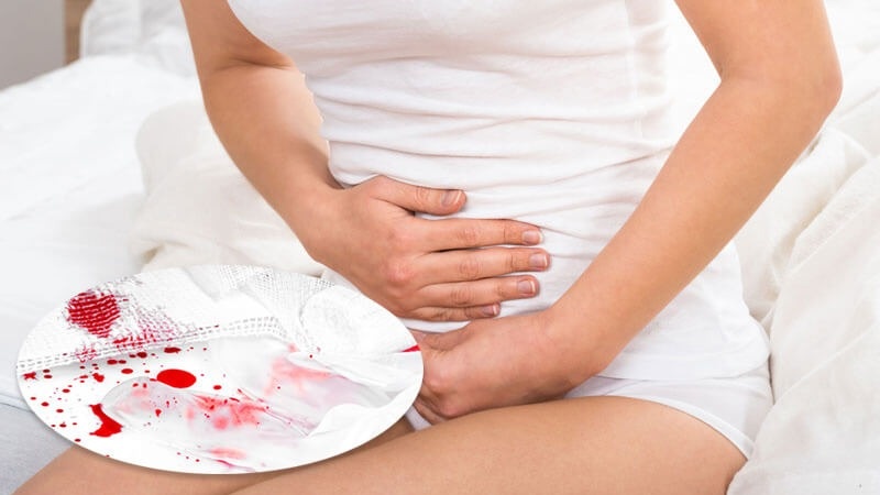 Xuất huyết 3 tháng đầu thai kỳ khiến rất nhiều mẹ bầu lo lắng