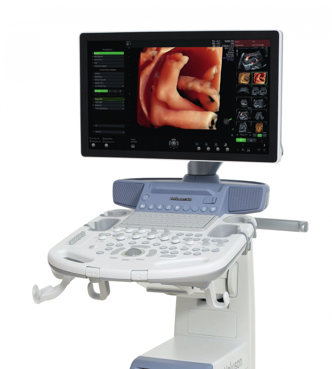 Máy Voluson cho hình ảnh rõ ràng đến từng chi tiết nhỏ