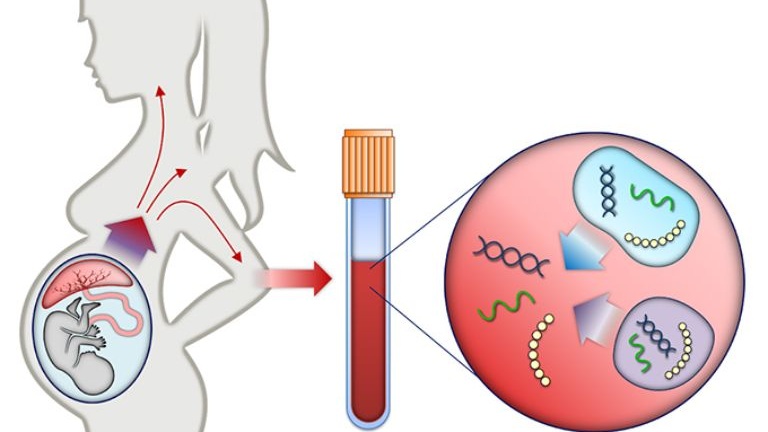 NIPT test có độ an toàn và tính chính xác cao