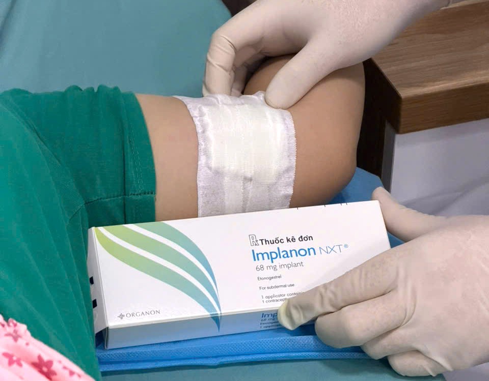 Phòng khám sử dụng que tránh thai chính hãng, miễn phí tháo que cũ