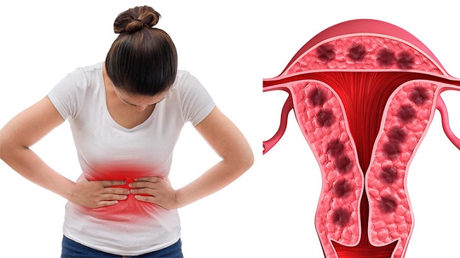 xuất huyết tử cung bất thường có thể gây ra nhiều hậu quả nghiêm trọng