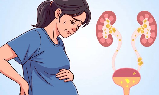 NTDTN có thể gây biến chứng lên thận của mẹ