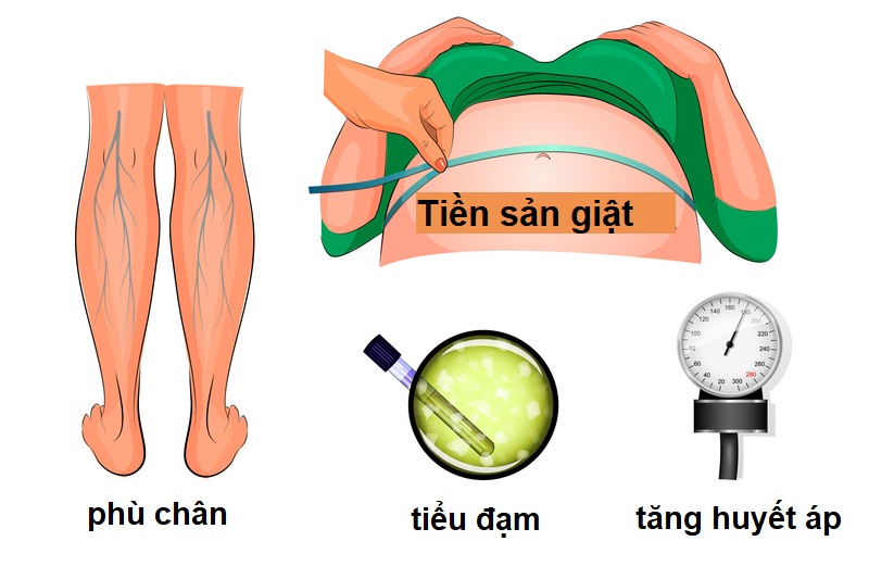 Tiền sản giật không được kiểm soát kịp thời có thể khiến thai nhi tử vong